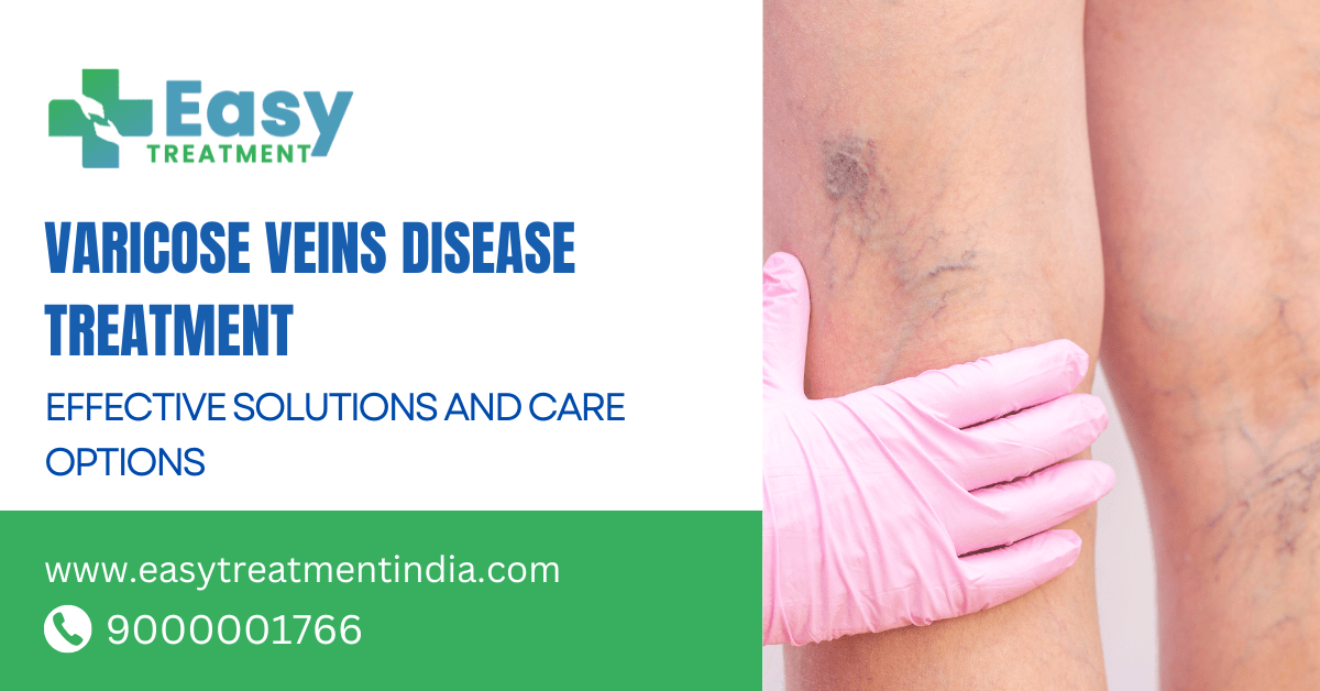 Doctor discussing varicose veins surgery with a patient, pointing to an image of legs with visible veins.