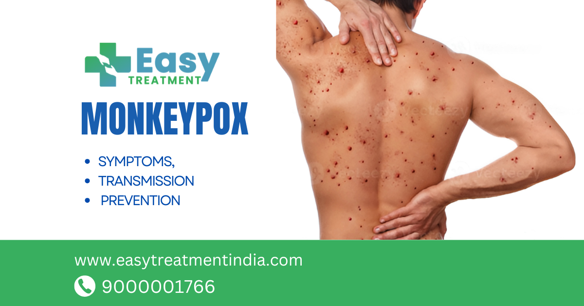 Illustration showing monkeypox symptoms, including fever, rash, and swollen lymph nodes, with a visual representation of virus transmission and prevention methods.